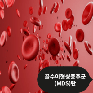 골수이형성증후군(MDS) 이해하기: 질환의 모든 것