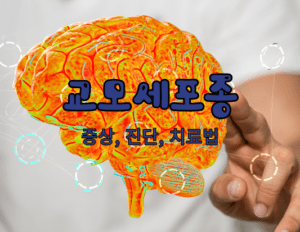 교모세포종 완벽 가이드: 증상, 진단, 치료법 